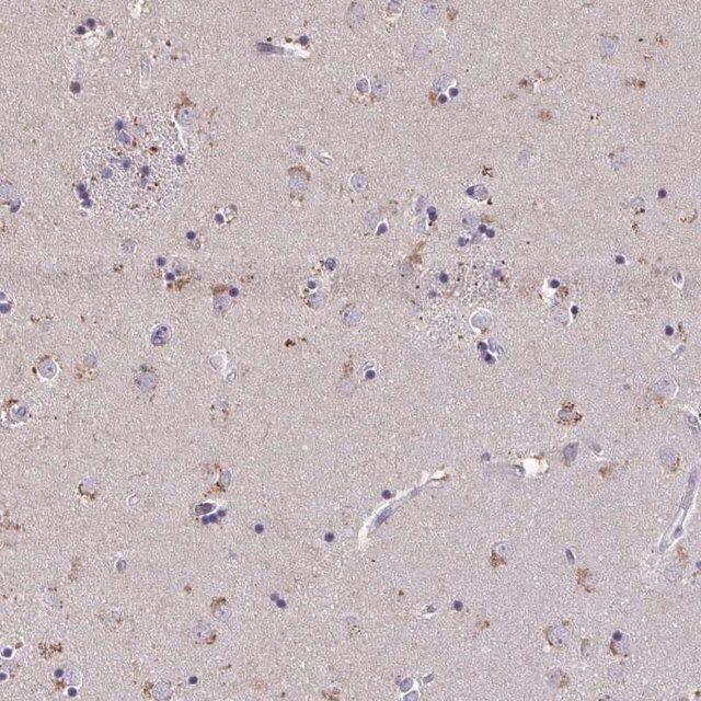 Anti-ZNF34 antibody produced in rabbit