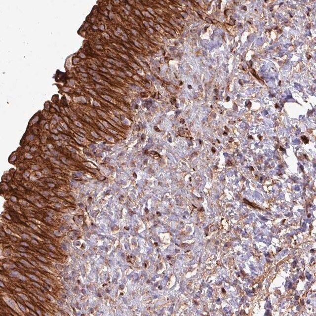 Anti-ZNF300 antibody produced in rabbit