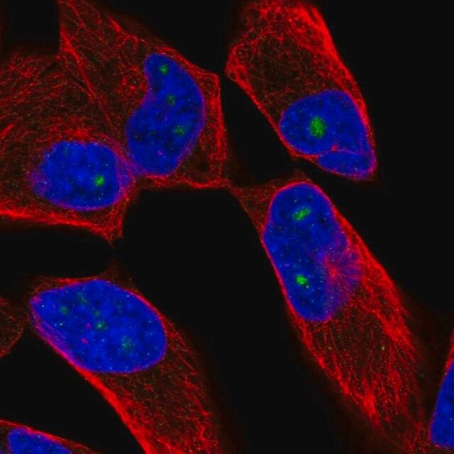 Anti-ZNF136 antibody produced in rabbit
