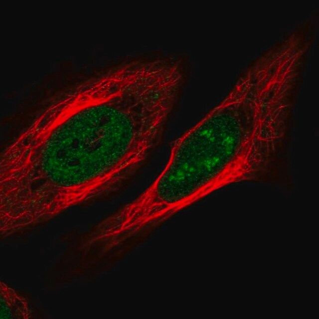 Anti-ZNF554 antibody produced in rabbit