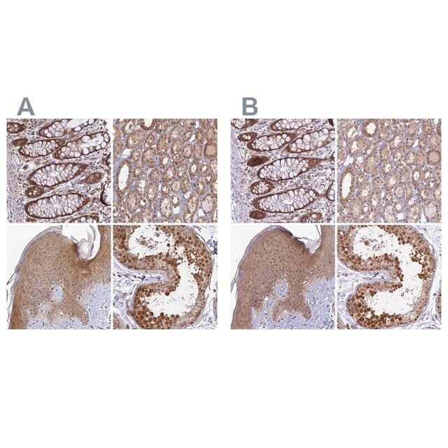 Anti-WDR61 antibody produced in rabbit
