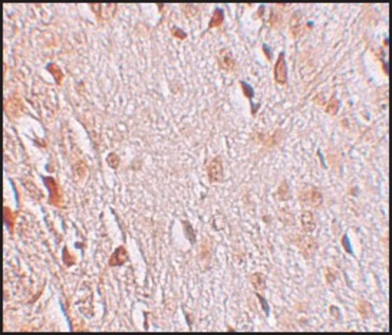 Anti-WIZ antibody produced in rabbit