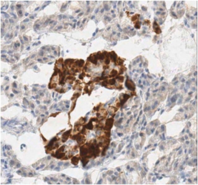Anti-WIPI-2, clone 1B8.1 Antibody
