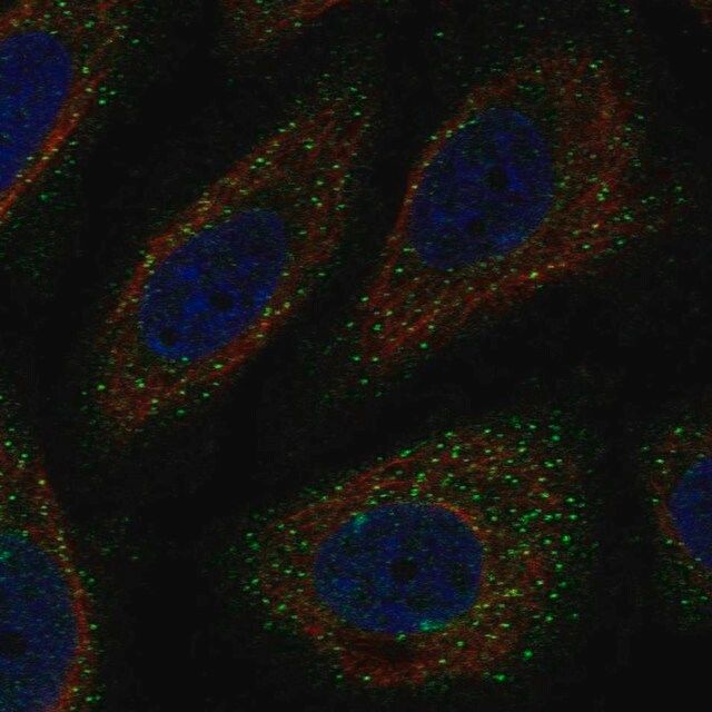 Anti-WNK3 antibody produced in rabbit