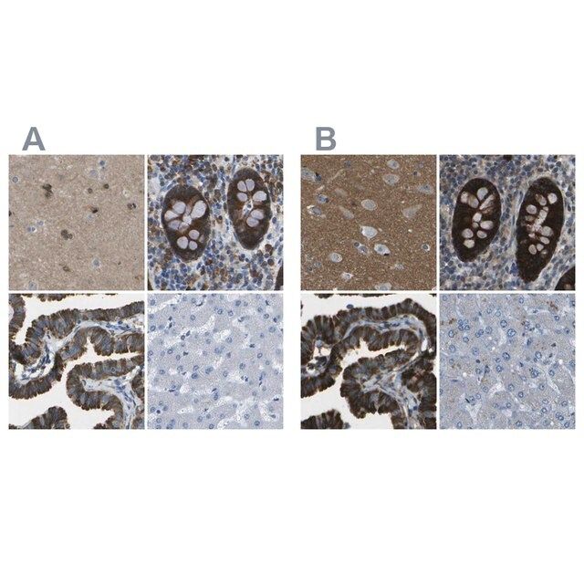 Anti-WNK2 antibody produced in rabbit