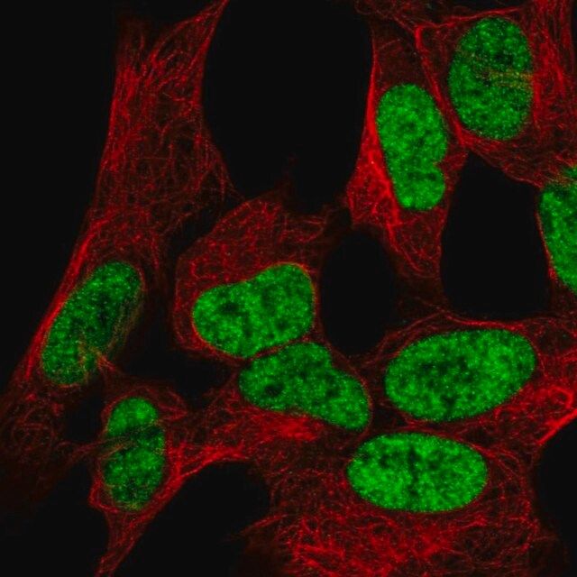 Anti-WIZ antibody produced in rabbit