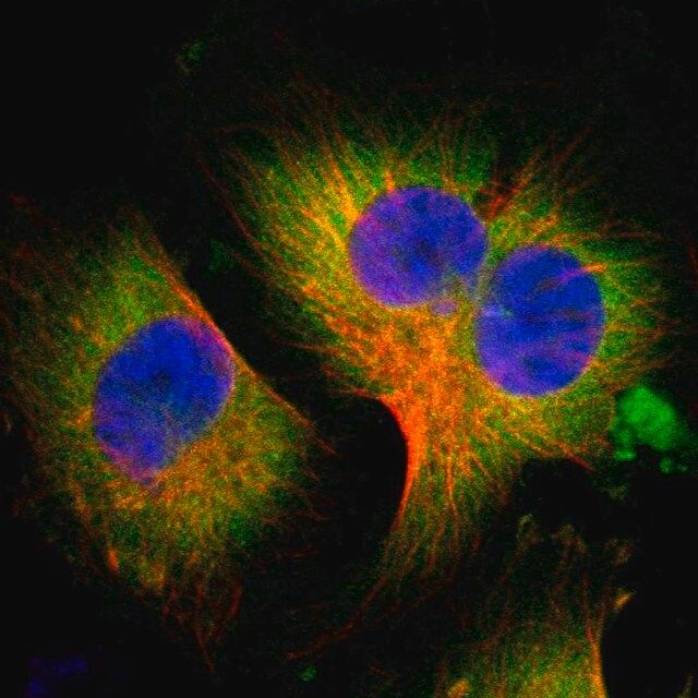 Anti-WISP1 antibody produced in rabbit