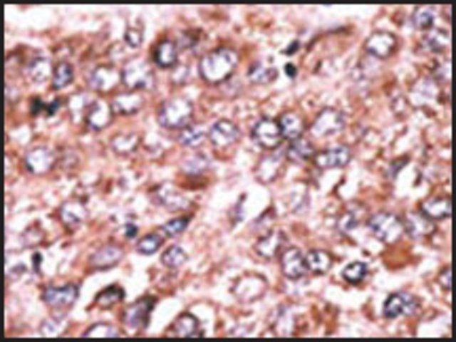 Anti-WISP3 (center) antibody produced in rabbit