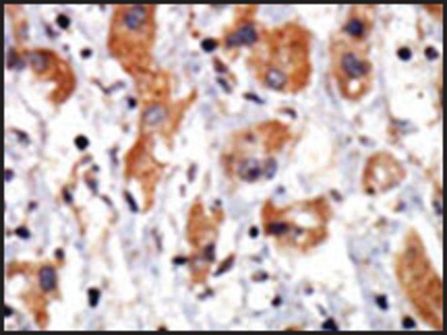 Anti-WNK1 (C-term) antibody produced in rabbit