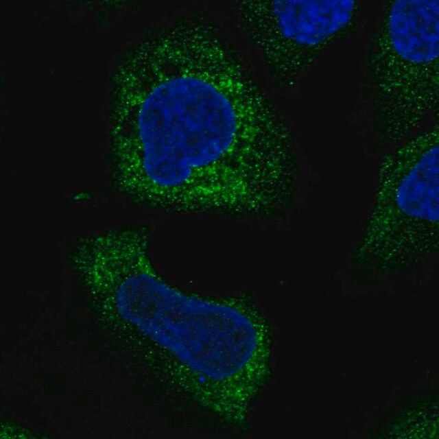 Anti-WISP3 antibody produced in rabbit