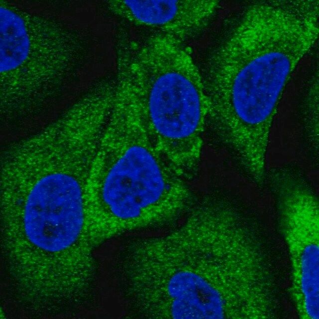 Anti-WNK1 antibody produced in rabbit