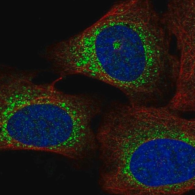 Anti-WISP3 antibody produced in rabbit