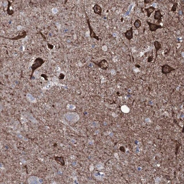 Anti-WIPF3 antibody produced in rabbit
