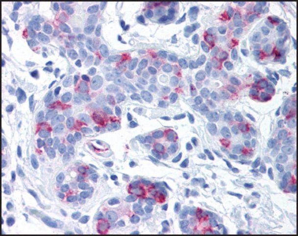 Anti-WNT8A antibody produced in rabbit