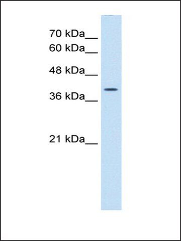 Anti-WNT2B antibody produced in rabbit