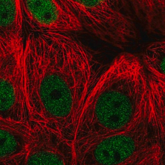 Anti-ZBTB21 antibody produced in rabbit
