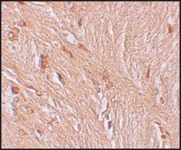 Anti-ZBTB3 antibody produced in rabbit