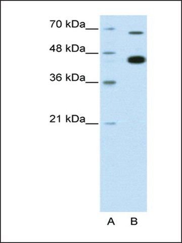 Anti-ZBTB33 antibody produced in rabbit