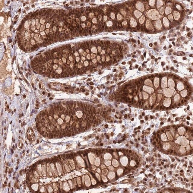 Anti-ZBTB12 antibody produced in rabbit