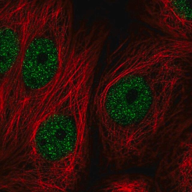 Anti-ZBTB21 antibody produced in rabbit
