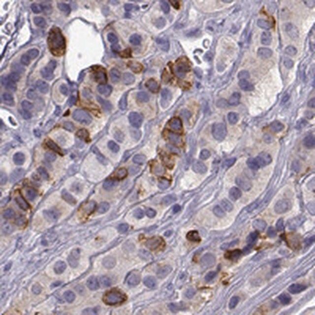 Anti-ZBTB8B antibody produced in rabbit