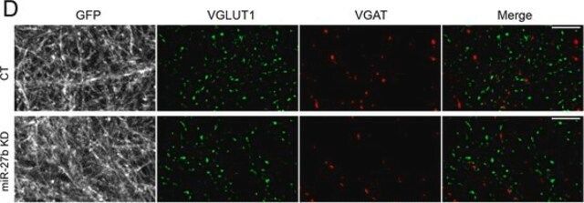 Anti-Vesicular Glutamate Transporter 1 Antibody