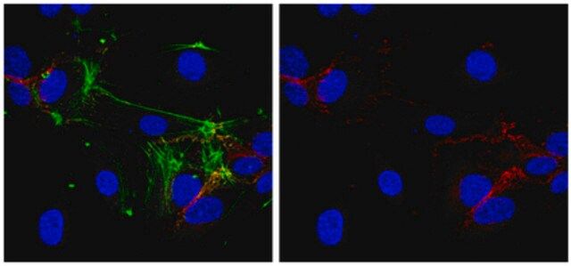 Anti-VE-cadherin Antibody, clone BV6