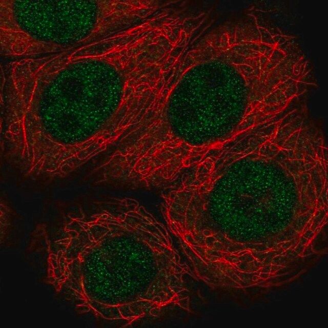 Anti-VHL antibody produced in rabbit