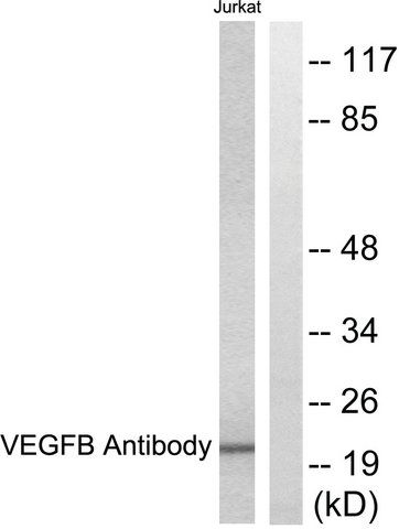 Anti-VEGFB antibody produced in rabbit