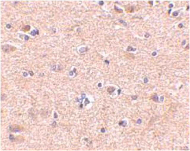 Anti-VGF Antibody