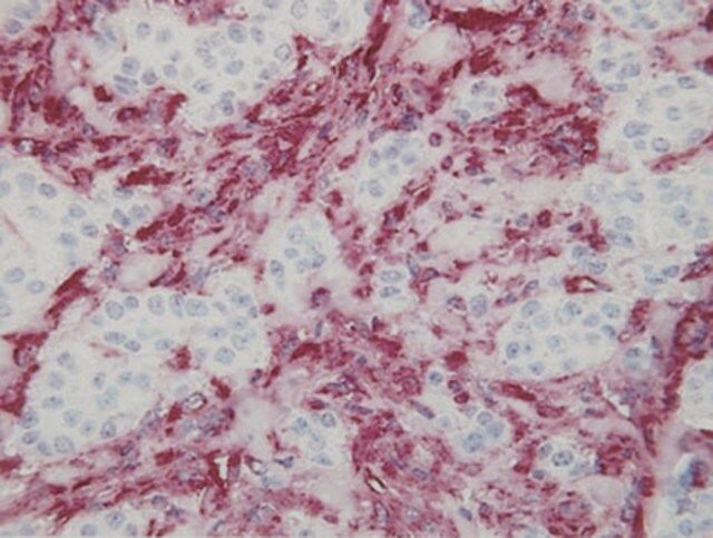 Anti-Vimentin Antibody, clone V9