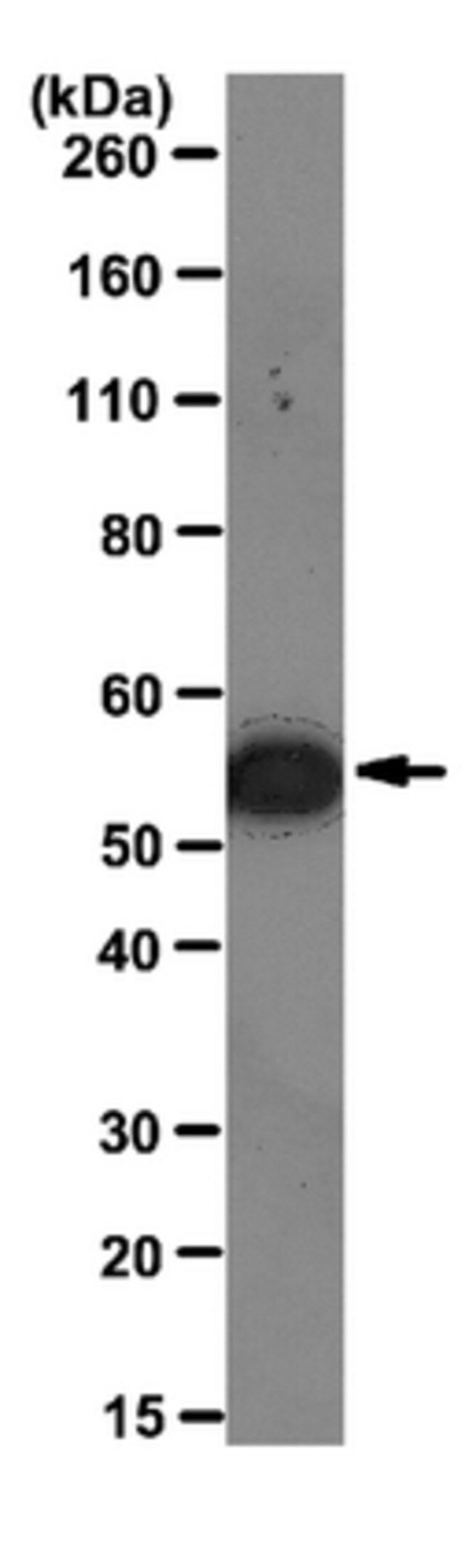 Anti-Vimentin Antibody, clone 3CB2