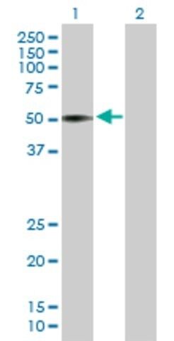 Anti-VIPR1 antibody produced in mouse