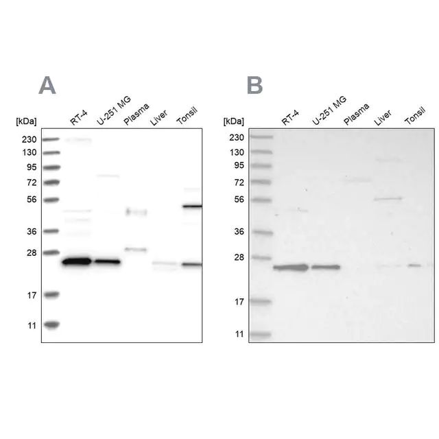 Anti-VPS28 antibody produced in rabbit