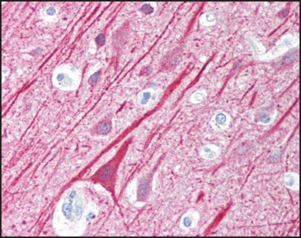 Anti-VISA (AB1) antibody produced in rabbit