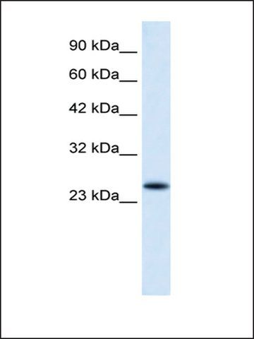 Anti-VPS24 antibody produced in rabbit