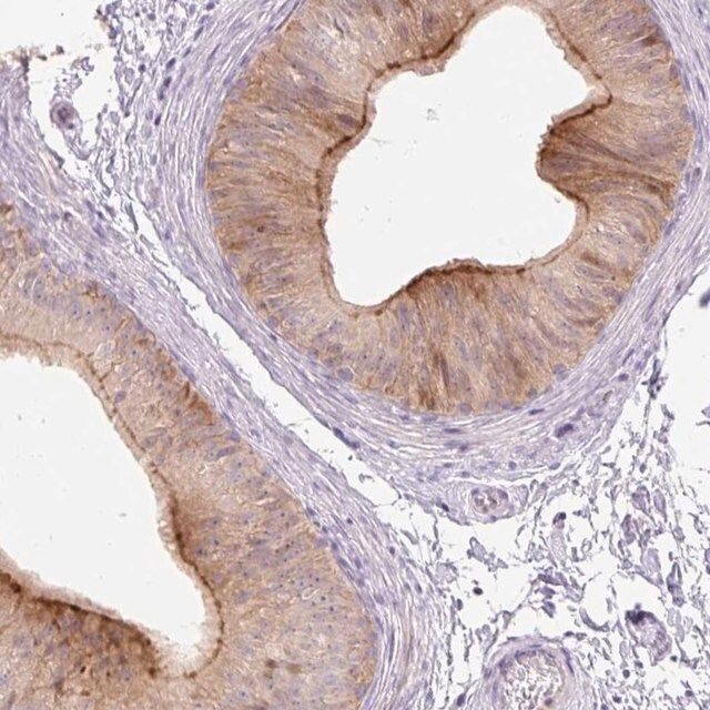 Anti-VPS25 antibody produced in rabbit