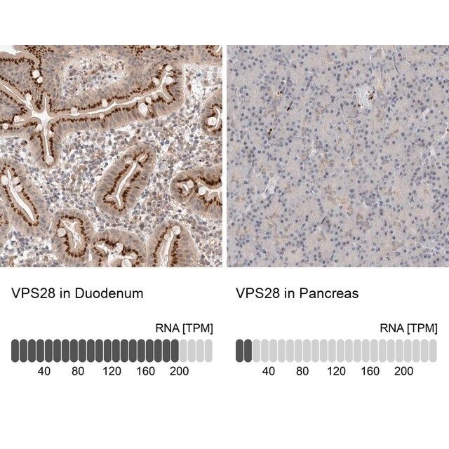 Anti-VPS28 antibody produced in rabbit