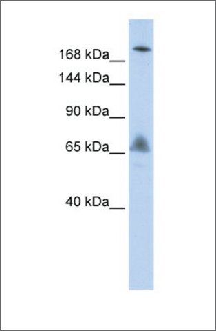 Anti-VPS8 antibody produced in rabbit