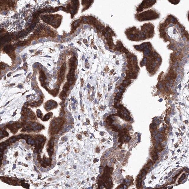 Anti-VPS8 antibody produced in rabbit