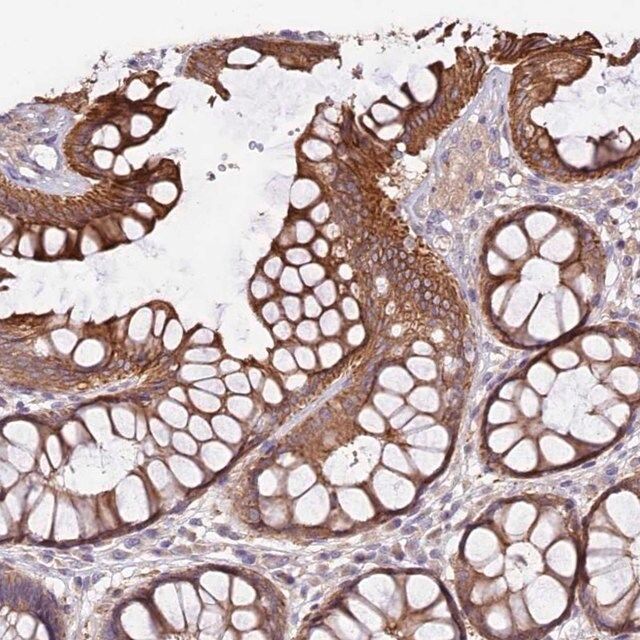 Anti-VPS11 antibody produced in rabbit