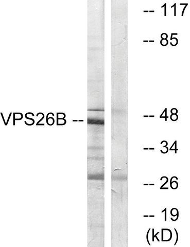 Anti-VPS26B antibody produced in rabbit