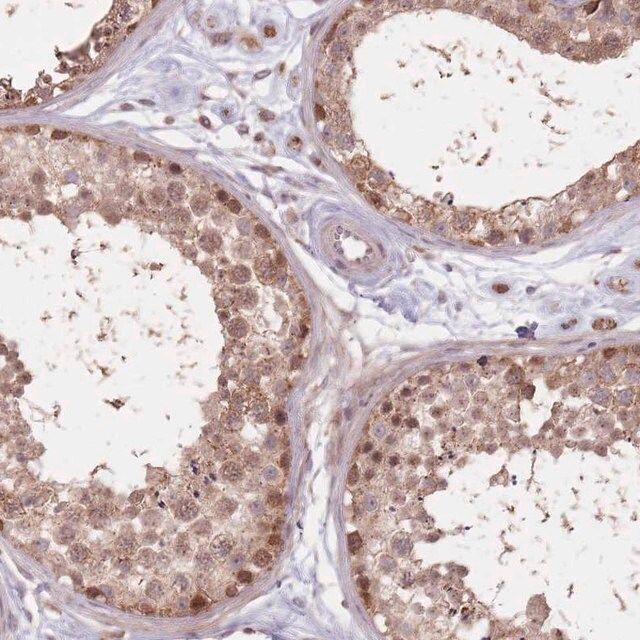 Anti-VPS52 antibody produced in rabbit