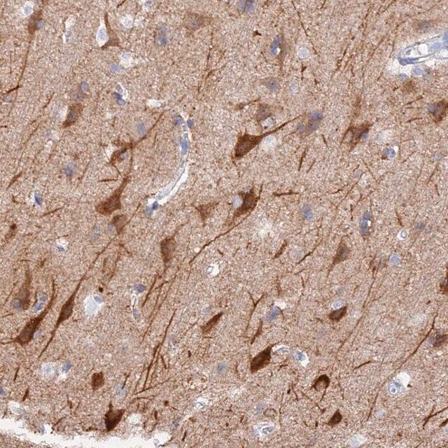 Anti-VPS33B antibody produced in rabbit