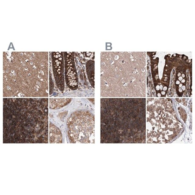 Anti-VPS37B antibody produced in rabbit