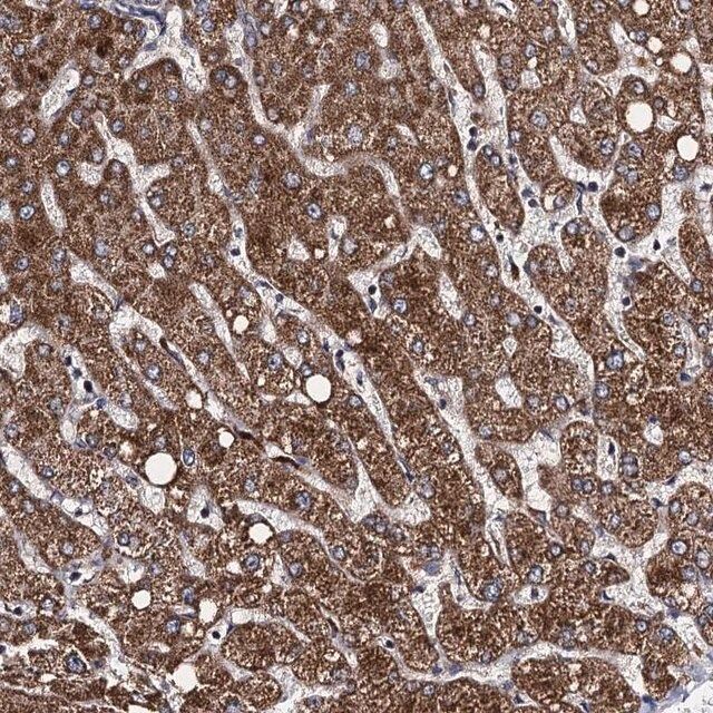 Anti-VPS37D antibody produced in rabbit