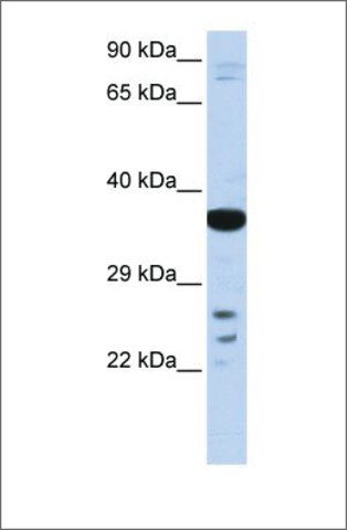 Anti-VSX1 (ab2) antibody produced in rabbit