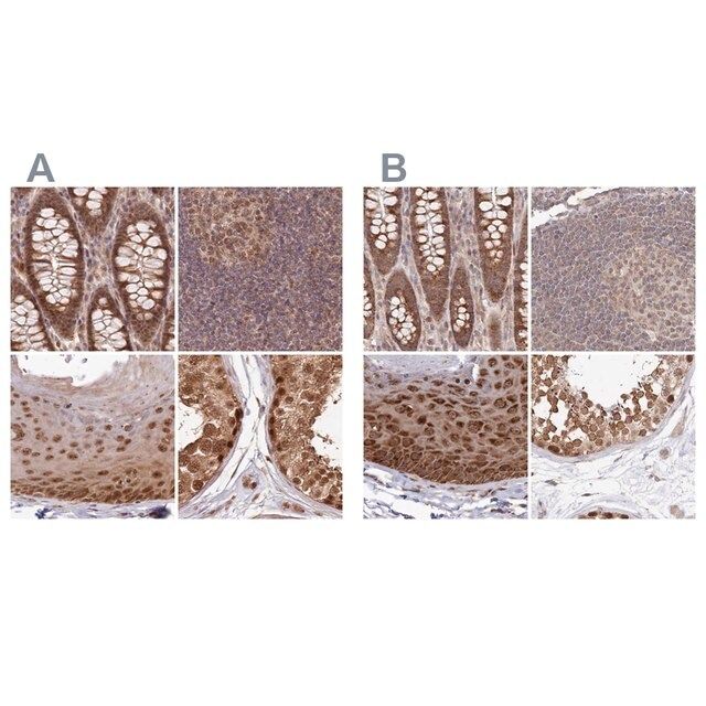 Anti-WAPL antibody produced in rabbit