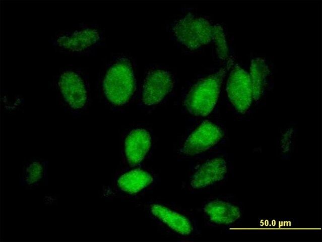 Anti-WAPAL antibody produced in mouse
