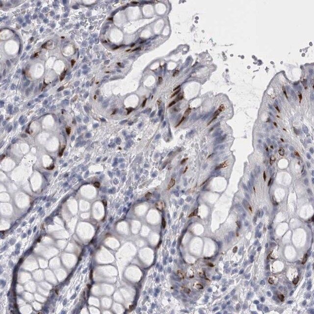 Anti-VWDE antibody produced in rabbit